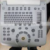 Hot Sale Color Doppler Ultrasound Machine for Sale thumbnail-3