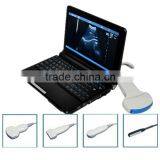 Cheap Price 10 Inch Laptop Ultrasound Scanner Convex Linear Micro-convex Rectal Transvaginal Probe thumbnail-1