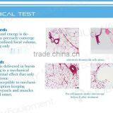 Best Mini Ultrasound Machine Face Lifting Portable HIFU Back Tightening thumbnail-5