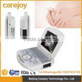 Hign Quality Ultrasound Machine With Low Price thumbnail-1