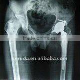 Low Price and High Quality Digital Dry Imaging Film Compatible With Fuji and Agfa Printers thumbnail-1