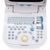 CE Approved Portable Ultrasound Scanner With 3.5Mhz Multi-frequency Convex Probe RUS-9000A thumbnail-2