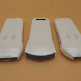 10MHz Apple Ios Android Wireless Ultrasound Probes Ultrasound Scanner thumbnail-2