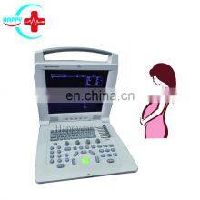 HC-A004 Cheapest Good Quality Medical Full Digital Portable Laptop B/W Ultrasound Scanner for Pregnancy thumbnail-2