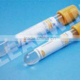 Colourful Disposable Medical Vacuum Blood Collection No Additive Blood Tube