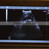 CE FDA Mark 10 Inch Laptop Veterinary / Vet Ultrasound Scanner With 3.5MHz Convex Probe Rectal With USB Port thumbnail-3