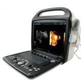 Премиумный 4D цветной допплеровский ультразвуковой сканер thumbnail-3