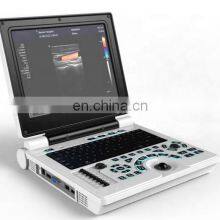 Portable Full Digital 15inch 2D 4D Medical Ultrasound Instruments for Hospital Use thumbnail-2