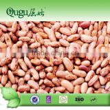 popular 400g canned light speckled kidney beans to yemen market