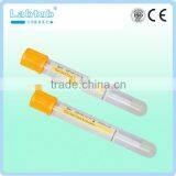 Separation Gel Vacuum Blood Collection Tube (high Quality Vacutainer) thumbnail-3