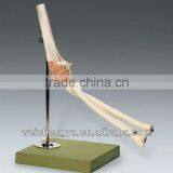 Life-Size Elbow Joint Model