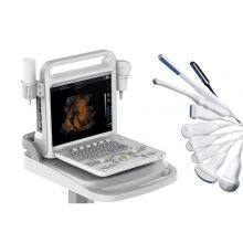 C20 Color Ultrasound Machine, Color Doppler thumbnail-2