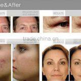 Ultrasonic Beauty Machine With High Frequency Vacuum Spray OL-3001A Apparatus thumbnail-5