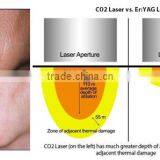 Wrinkle Removal Portable Skin Tightening Manufacturer Skin Tightening Fractional Co2 Skin Tightening Laser Equipment Co2 Laser Scar Removal Acne Treatment Remove Neoplasms thumbnail-5