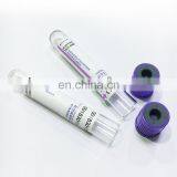 Edta K2 K3 Edta Blood Collection Tubes thumbnail-5