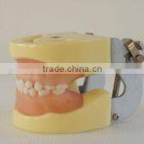 Pediatrics Typodont Teeth Model (20 Teeth) With Removable Screw Teeth thumbnail-2