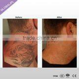 OEM/ODM Dispelling Tender Skin Color&dark Tattoo Removal Aesthetic Machine thumbnail-6
