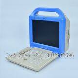 Portable Color Doppler Laptop Ultrasound, Dw-C60 Ultrasonic Machine thumbnail-4