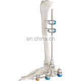 Высококачественный костный молоток, хирургический ортопедический инструмент, внешний фиксатор голеностопного сустава, медицинские инструменты, костный инструмент