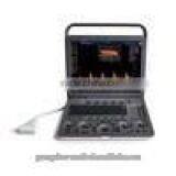 Loptop Fully Digital Ultrasound Scanner Ultrasound Scanner Color Doppler thumbnail-1