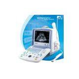 Digital Portable Ultrasound Scanner (BW8S)