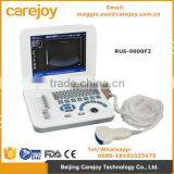Carejoy Ultrasound Machine Portable Ultrasound Scanner With Multi Frequency Probe for Hospital Clinics Community RUS-9000F2 thumbnail-1