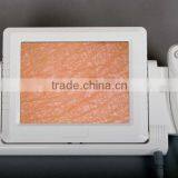 AYJ-J015 Portable Skin And Hair Analyzer Machine/Professional Magic Mirror Portable 3d Skin and Hair Analyzer Machine thumbnail-4