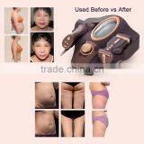 Factoty Wholesale New Korean Technology Ultrasonic Weight Loss Machines thumbnail-6