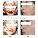 Best Quality of Three Color Led PDT Light//photodynamic Therapy Acne Treatment thumbnail-6