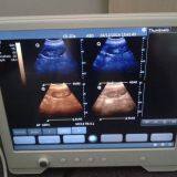 15'' Touch Screen High Resolution Portable Ultrasound Scanner Ultrasonic Diagnostic Device With Multi-frequency Probes thumbnail-3