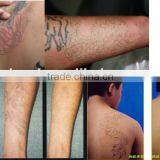 Best Selling Beauty Products 1064nm & 532nm Q-Switched ND YAG Laser Tattoo Removal Cheap Machine thumbnail-3