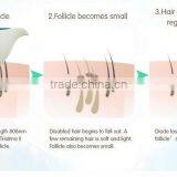 The Best Permanent Laser Hair Removal Machine for Hair Removal thumbnail-5