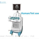 YJ-U100T B/W Trolley Ultrasound Scanner