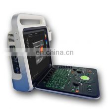 Wholesale medical ultrasound instruments 15inch color doppler ultrasound machine