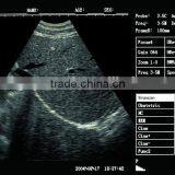 Best Vet Ultrasound Scanner for Cow thumbnail-6