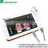 Back Tightening HIFU Age Hifu 2000 ShotsPortable Machine Face Lift Skin Rejuvenation thumbnail-3