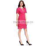 Fashion Lace Patchwork Short Frock Lady Image Skater Dress thumbnail-5