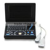 Light Weight PC Platform 10.4 Inch Laptop Ultrasound Scanner With 3.5Mhz Convex Probe Multi-frequency thumbnail-2