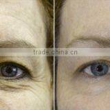 Skin Rejuvenation Wrinkle Removal RF Fractional Microneedle thumbnail-6