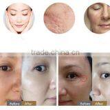 Best 755nm Laser Machine 3in1 Professional Multifunction POPIPL's 755nm Alexandrite Laser and Long Pulsed Laser 1064nm thumbnail-5