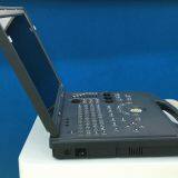 Color Doppler Pregnancy Scanner Ultrasound Machine thumbnail-2