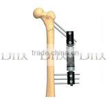 Bone Lengthening Fragment External Fixator