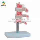 BIX-A1015 Human Osteoporosis Anatomical Model (3 Vertebrae) thumbnail-2