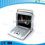LTE6 Laptop Cardiac Color Doppler Vascular Ultrasound Scanner Machine