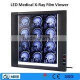 High Brightness X Ray Film Viewer or Negatoscope thumbnail-1