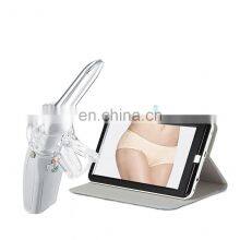 Vaginal Self-Exam Colposcope Digital Video Colposcope Gynecological Mini-Colposcope thumbnail-2