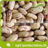 Edible Light Speckled Kidney Beans For Canning thumbnail-6