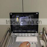 C7 KONTED 3D Portable Color Doppler Ultrasound Machine thumbnail-2