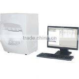 Computer Visual Field Analyzer Eye Perimeter thumbnail-1