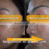 1-10Hz ND Yag Laser Modules / ND Yag Tattoo Removal Laser Equipment Laser Tattoo Removal Machine Tattoo Removal Laser Machine thumbnail-2